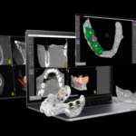 Dima radiologica in chirurgia guidata: dalla pianificazione al posizionamento degli impianti