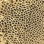 Rigenerazione ossea, il successo dipende anche dalla barriera impiegata