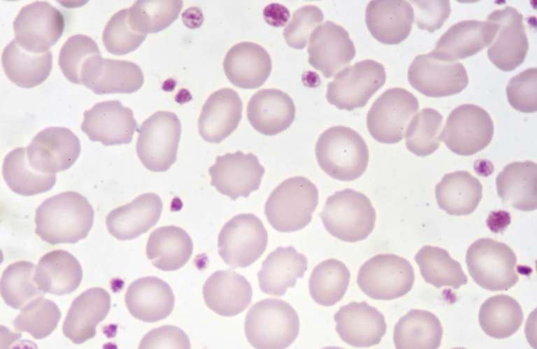 Rigenerazione pulpare, il ruolo dei concentrati di piastrine