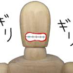 Il bruxismo può mettere a rischio la sopravvivenza degli impianti bruxismo