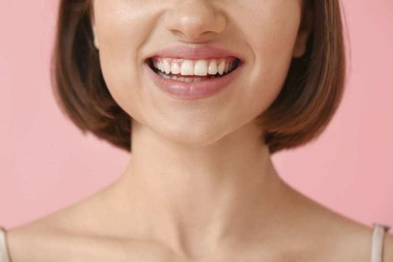 Mucosa cheratinizzata, se manca aumenta il rischio di perimplantite