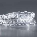 Bonding indiretto e tecnologia digitale, uno studio ne valuta l’accuratezza