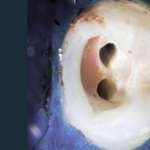 Sigillanti canalari, come scegliere quelli più adatti al caso