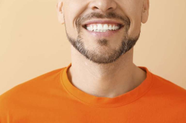 Denti sovrannumerari, uno studio ne descrive il fenomeno