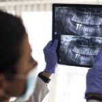 Ortopantomografia, grazie a un nuovo sistema “U-Net” è più accurata