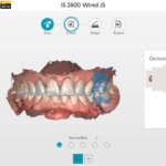 Scanner intraorale: come può avvantaggiare il vostro flusso di lavoro digitale?