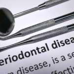 Parodontite, il ruolo dell’inflammasoma NLRP3 parodontite