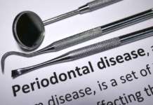 Parodontite, il ruolo dell’inflammasoma NLRP3 parodontite