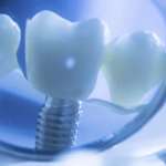 Osteotomia, ancora poche le evidenze scientifiche su come controllare il calore osteotomia calore