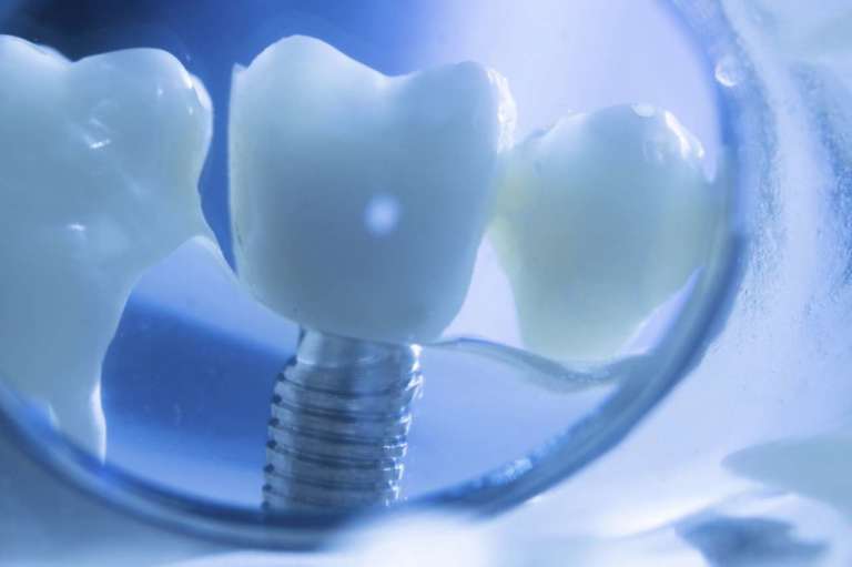 Osteotomia, ancora poche le evidenze scientifiche su come controllare il calore