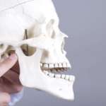 TMD e sistema mandibolare craniocervicale a confronto TMD