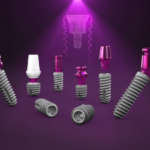 Nelle riabilitazioni implantari, il successo è anche una questione di design riabilitazioni implantari bredent