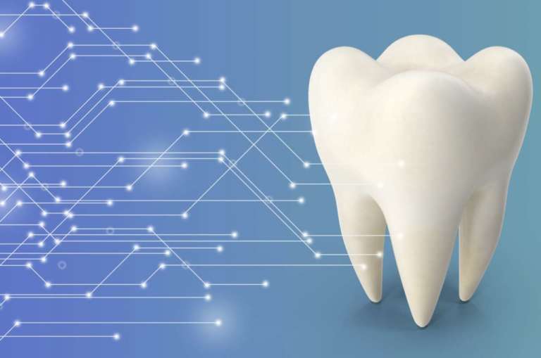 Carie e ipomineralizzazione, come individuarle con l’IA