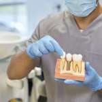 La rimozione degli impianti secondo una recente revisione sistematica