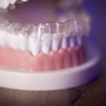 Trattamenti ortodontici e salute generale, un binomio da approfondire