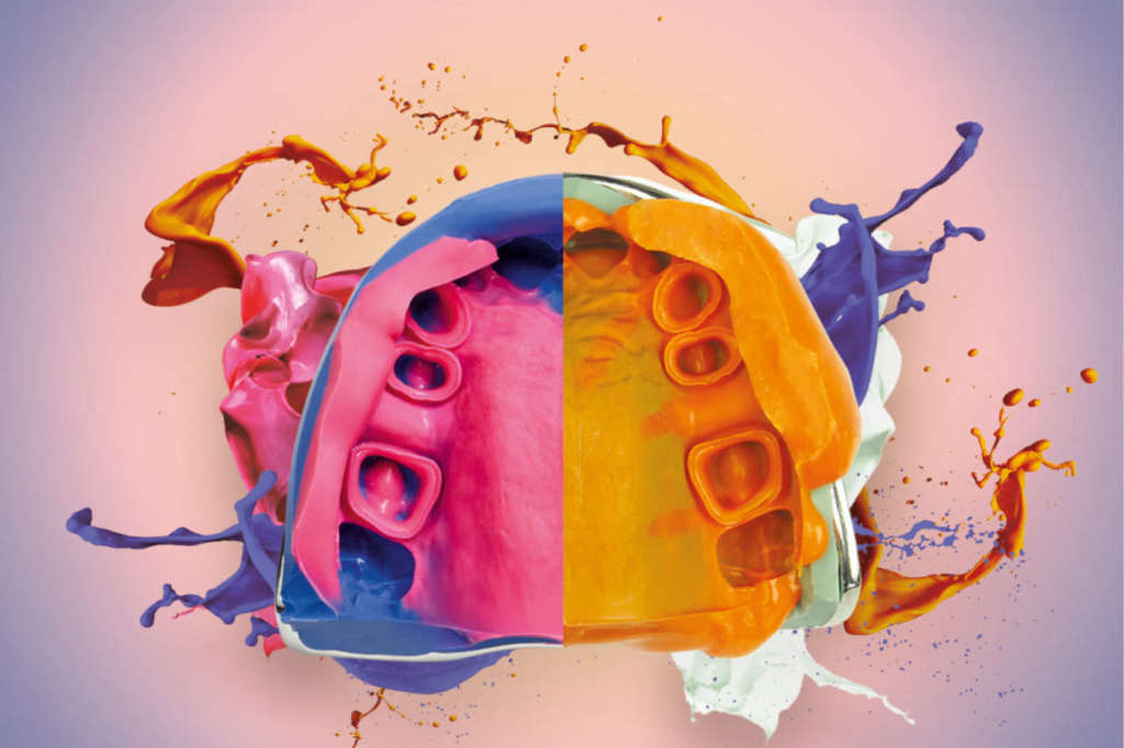 scelta siliconi impronte dentali