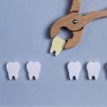 Rischio di sanguinamento post-operatorio, come valutarlo concretamente sanguinamento post-operatorio