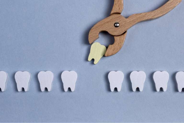 Rischio di sanguinamento post-operatorio, come valutarlo concretamente