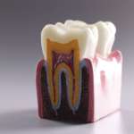 Rigenerazione della polpa dentale, uno studio sulle “resolvine” rigenerazione polpa dentale