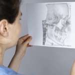 I disturbi temporomandibolari trattati con la telemedicina disturbi temporomandibolari