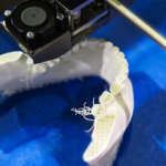 Stampanti 3D in odontoiatria: applicazioni e vantaggi stampanti 3D odontoiatria