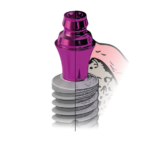 Osteointegrazione: il design implantare è un elemento chiave osteointegrazione