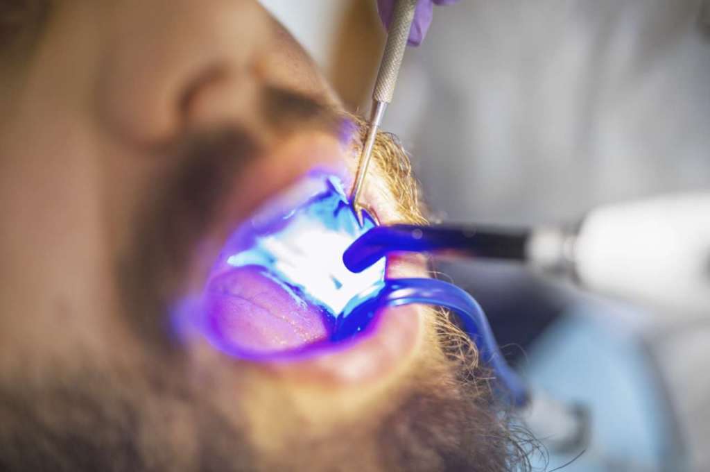 polimerizzazione prolungata