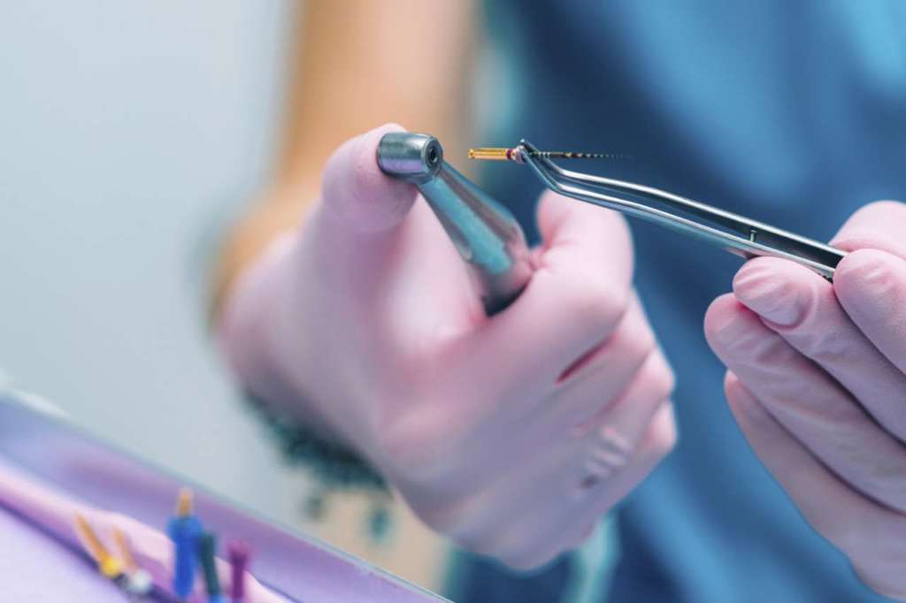 preparazione canalare