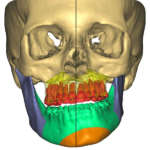 Chirurgia ortognatica ed estetica del volto