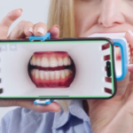 Align Technology lancia 4 innovazioni per l’odontoiatria digitale Align Technology