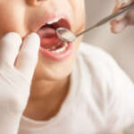 MIH: quanto ne sappiamo davvero? MIH ipomineralizzazione