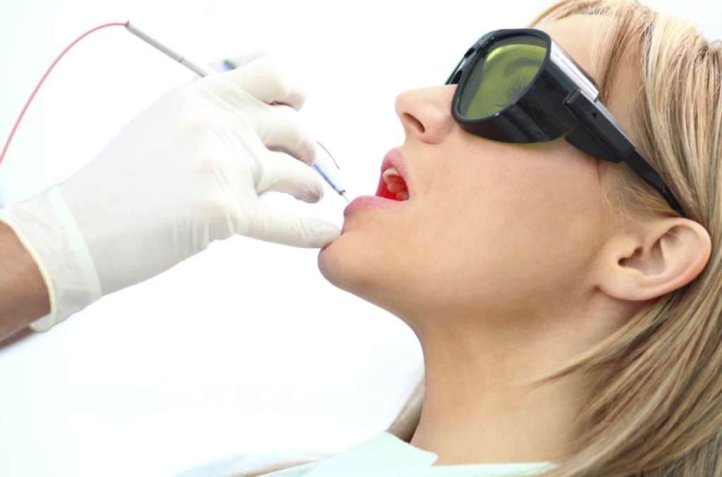 conservazione del sito alveolare