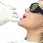 Conservazione del sito alveolare, gli effetti della fotobiomodulazione con il laser conservazione del sito alveolare