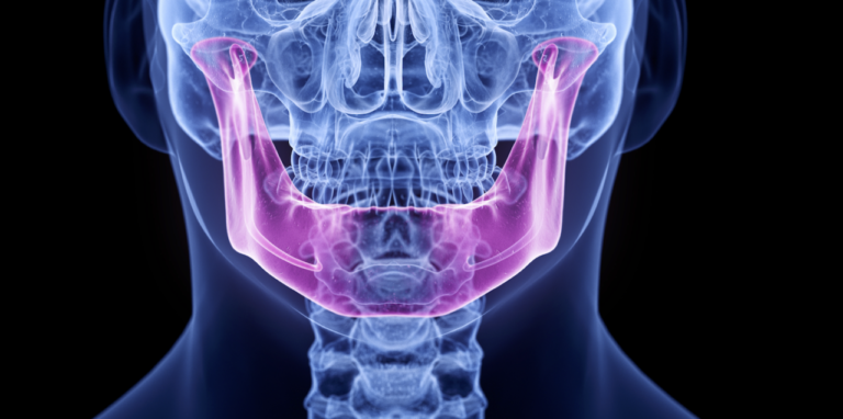 La densità minerale dell’osso alveolare mandibolare studiata per genere ed età