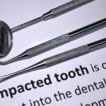 Canino mandibolare impattato e CAD-CAM canino mandibolare impattato