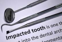 Canino mandibolare impattato e CAD-CAM canino mandibolare impattato