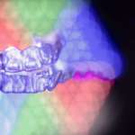 Ortodonzia e stimolazione elettrica, servono nuovi studi più approfonditi ortodonzia stimolazione elettrica