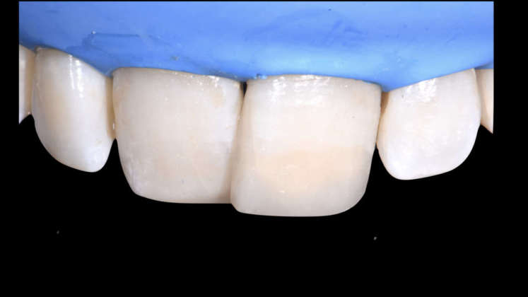 compositi clustershade