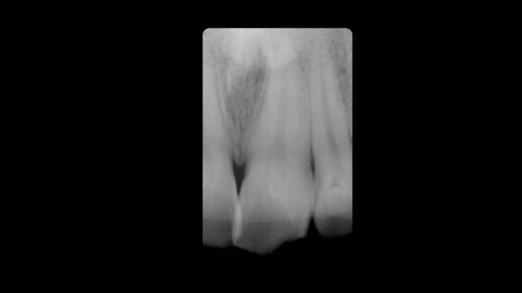 compositi clustershade