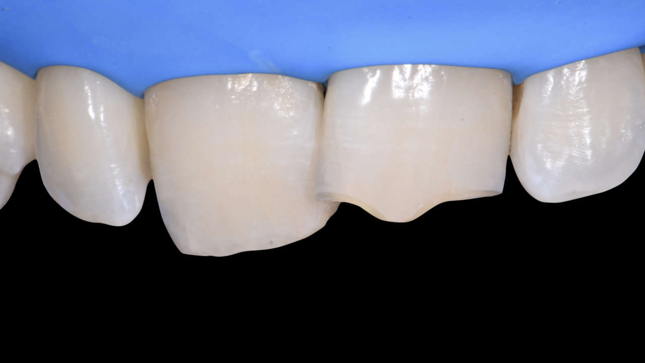 compositi clustershade