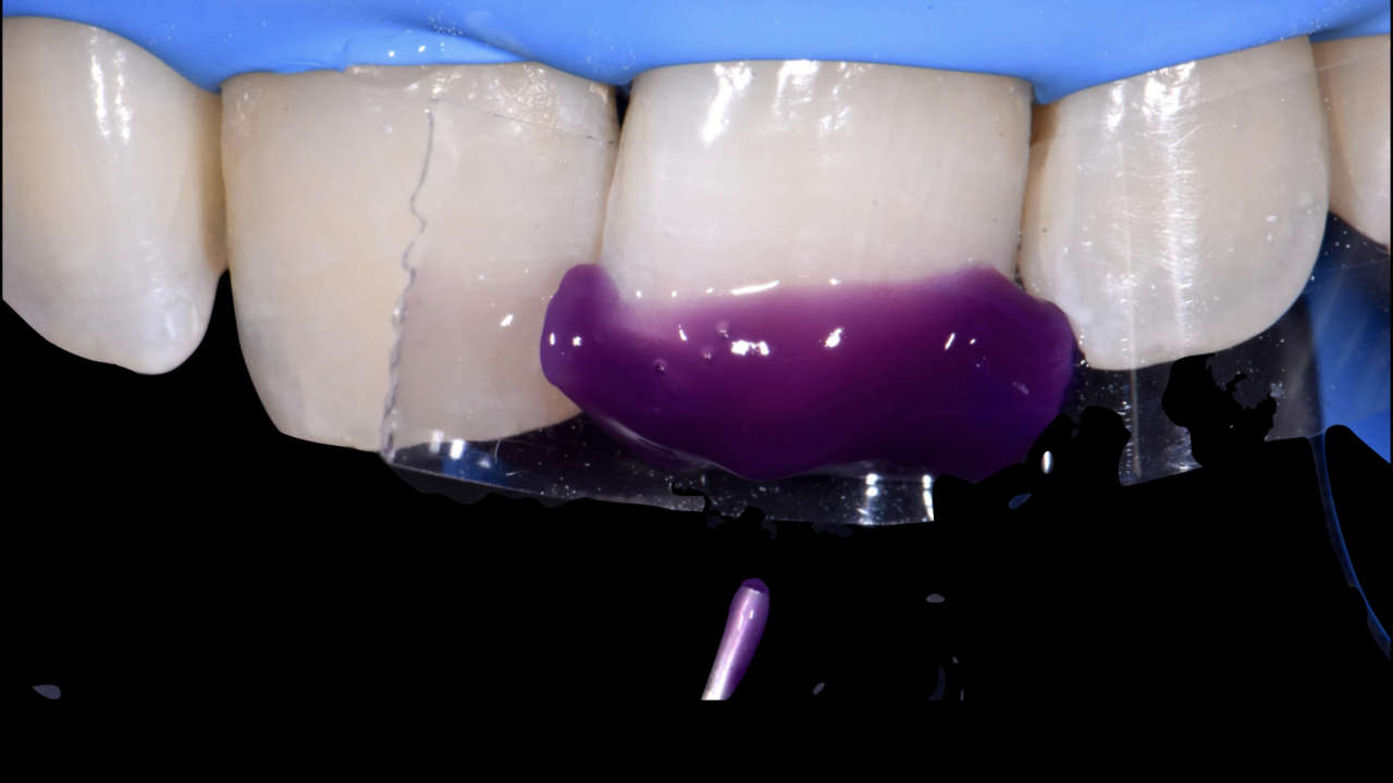 compositi clustershade