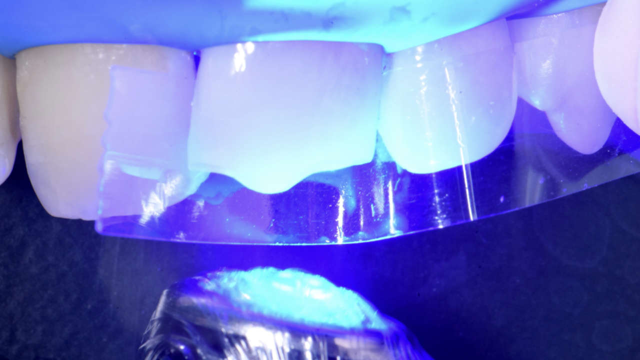 compositi clustershade