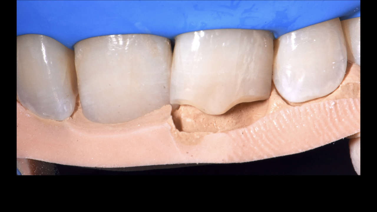 compositi clustershade