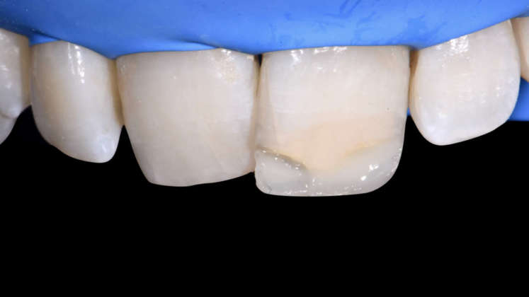compositi clustershade