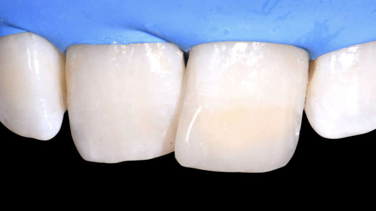 compositi clustershade