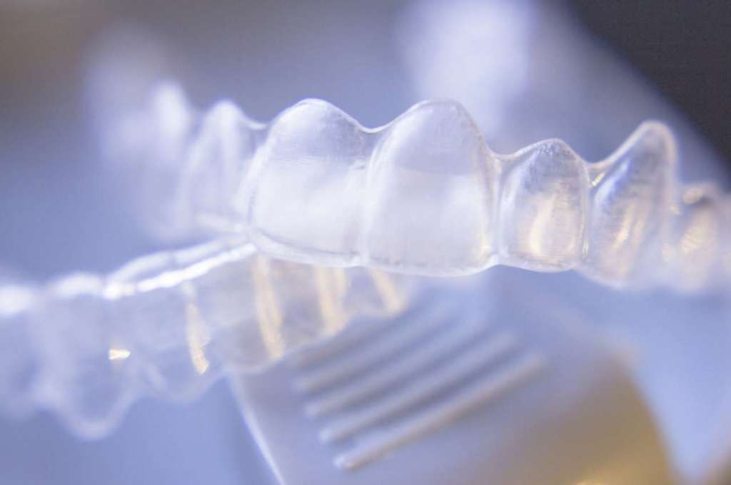 trattamento ortodontico e carie