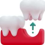 Sito alveolare post-estrattivo, una revisione della letteratura sul tema sito alveolare