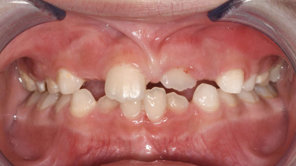 Odontoiatria 4.0 paziente pediatrico