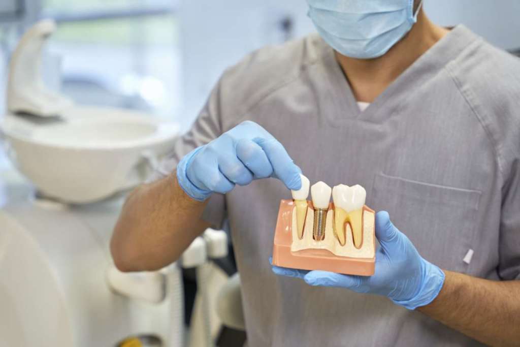 ampiezza biologica impianto dentale