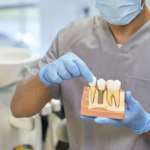 L'”ampiezza biologica” intorno all’impianto tenta di farsi spazio ampiezza biologica impianto dentale